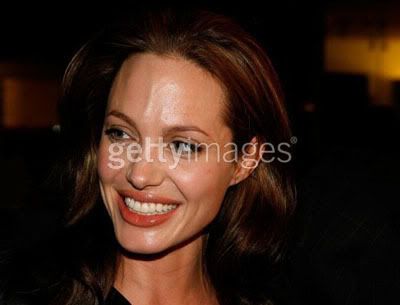 Angelina Jolie Vein Forehead. Pitt and Angelina Jolie at