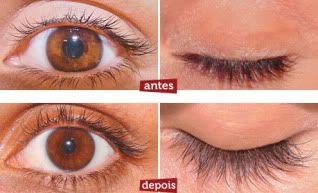 Latisse - Antes e Depois Latisse - Antes e Depois
