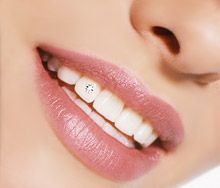 Piercing no dente Piercing no dente