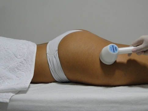 Vacuoterapia Vacuoterapia