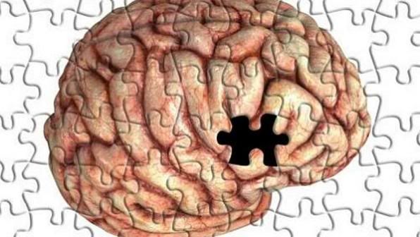 Mal de alzheimer Mal de alzheimer