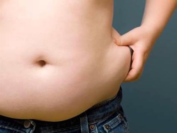 Obesidade infantil Obesidade infantil
