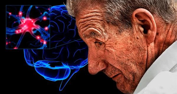 Mal de parkinson Mal de parkinson
