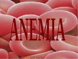 Anemia Anemia