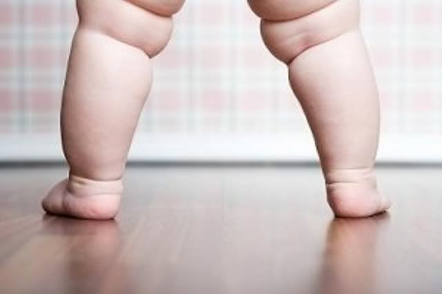 Obesidade em meninas Obesidade em meninas