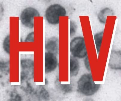 HIV HIV
