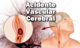 AVC - Acidente Vascular Cerebral AVC - Acidente Vascular Cerebral